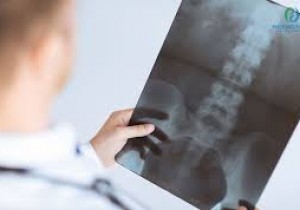 Về việc mời chào giá các mặt hàng thiết bị y tế phim X-quang  sử dụng trong khoa Chẩn đoán hình ảnh năm 2025-2026 tại  Bệnh viện Đa khoa khu vực miền núi phía Bắc Quảng Nam